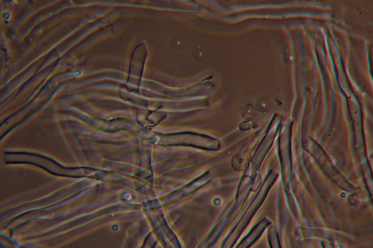 Climacocystis borealis (Fr.) Kotl. & Pouzar